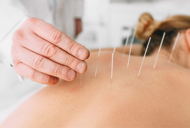 Acupuncture Boost