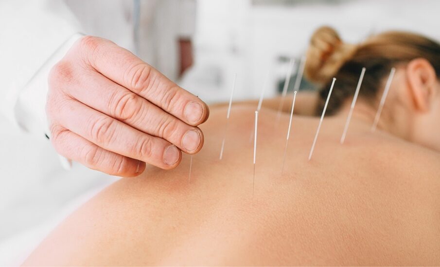 Acupuncture Boost