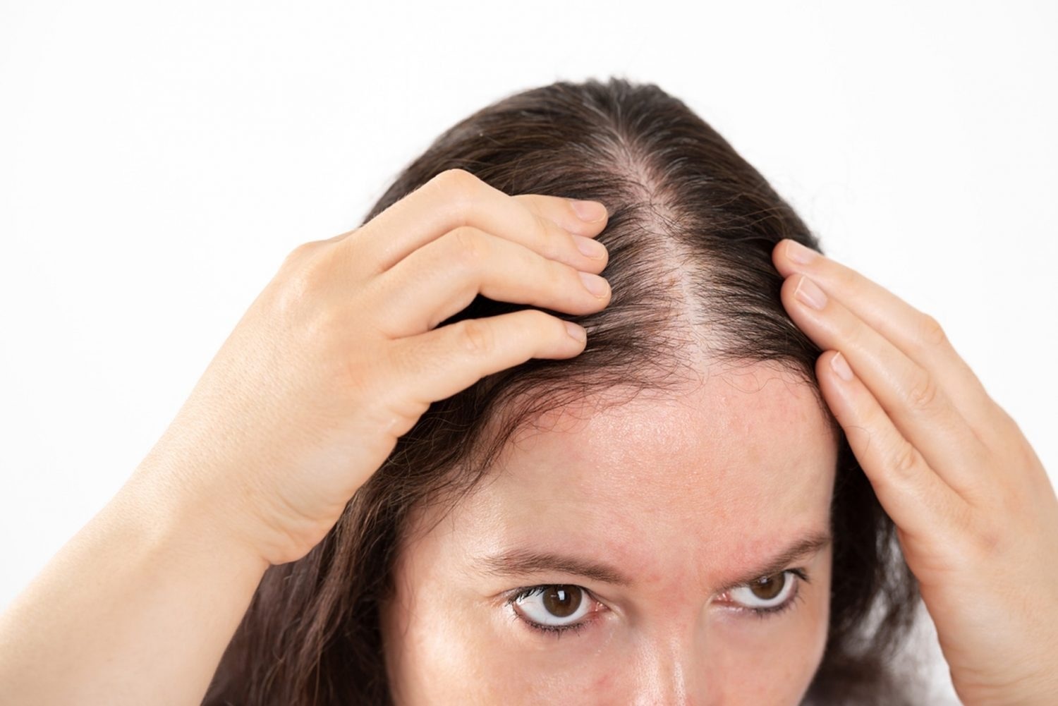 Reasons and remedies for female pattern hair loss