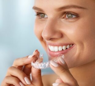 Invisalign