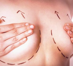 Breast Lift Surgery
